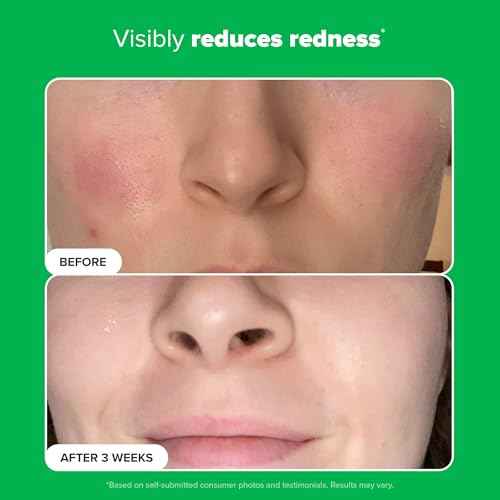 Paula's Choice BOOST 10% Azelaic Acid Booster Cream Gel Face Serum with Salicylic Acid, Oil-Free Skin Brightening Serum for Face, Fragrance-Free