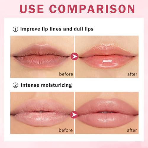 4PCS Honey Lip Balm Hydrating Honey Lip Mask Overnight Propolis Bee Lip Balm Prevention Dry and Cracked Lip Scrub Exfoliator (Honey+Strawberry+Coconut+Watermelon)