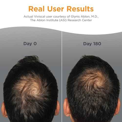 Viviscal Men's Hair Growth Supplements for Thicker Fuller Hair, Clinically Proven Collagen Complex, 60 Tablets 1 Month Supply