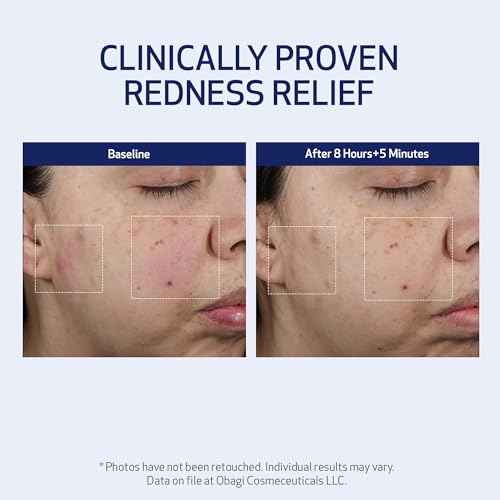 SUZANOBAGIMD Moisture Restore ? Medical-Grade Multi-Layered Moisture Provides Redness Relief, Long-Lasting Hydration + Improves Skin Texture & Firmness ? Suitable for All Skin Types ? 1.7 oz