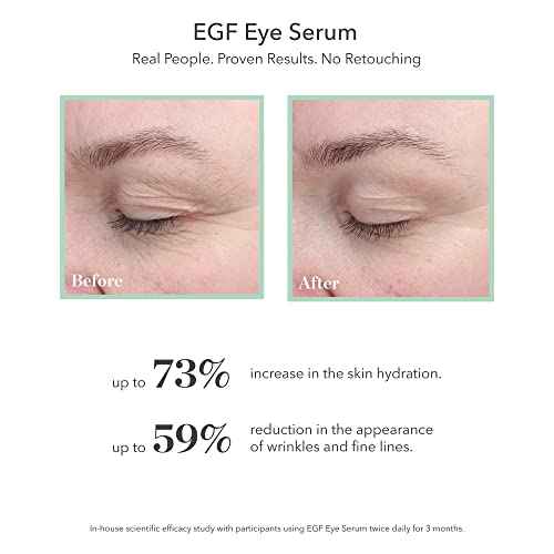 BIOEFFECT EGF Eye Serum with De-Puffer Rollerball, Anti-Aging, Moisturizing Contour Gel To Visibly Reduce Wrinkles, Puffiness, Fine Lines with Barley Growth-Factor Protein