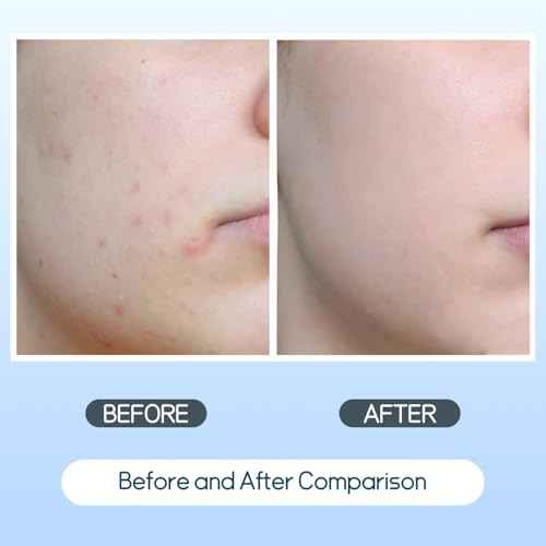 Salicylic Acid Toner Pads Face Care, Gentle Pore Shrinking Face Exfoliator Toner Pads, Soothing Skin Care Dual Texture Salicylic Acid Pad, Oil Control Deep Cleansing Facial Cotton (Pack of 70)