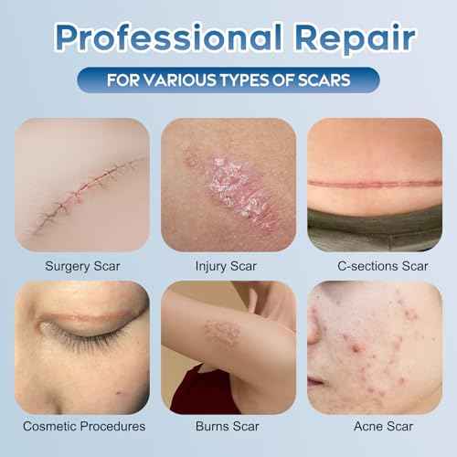 Advanced Silicone Scar Gel for Face & Body ? Silicone Scar Cream for Old & New Scars, Reduces Appearance of Scars from Acne, Surgery, Burns, Injuries, C-Sections & More (1.76 Ounce)