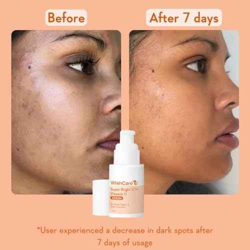 WishCare Vitamin C Face Serum with Niacinamide, Ferulic Acid & Botanical Extracts ? Serum for All Skin Types, 30ml