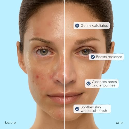 MAREE Face Exfoliator ? Microdermabrasion Facial Scrub & Exfoliating Face Wash for Women ? Collagen & Glycolic Acid ? Gentle Scrub and Exfoliant ? Men Exfoliating Scrubber ? Exfoliante Facial Cleanser