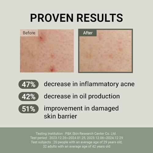 JUMISO Snail Mucin 88 Peptide Cream - Korean Face Moisturizer 5-Peptide Complex Collagen Boost Hyaluronic Acid Niacinamide Damaged Skin Repair - Sensitive Skin Non-Comedogenic 3.38 oz.