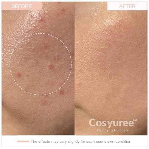 Collagen Deep Absorbing Hydrogel Mask, Korean Collagen Hydrogel Mask, Overnight Face Mask, Hydrating, Glass skin, Rejuvenation, Korean Skincare, 34g x 5ea