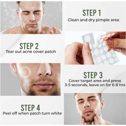 Clear Pimple Patches ? 108 Ct Hydrocolloid Acne Patches w/ Salicylic Acid & Tea Tree Oil ? Fast-Acting Zit Stickers for Face, Blemish & Spot Treatment ? Invisible, Waterproof, Gentle for All Skin