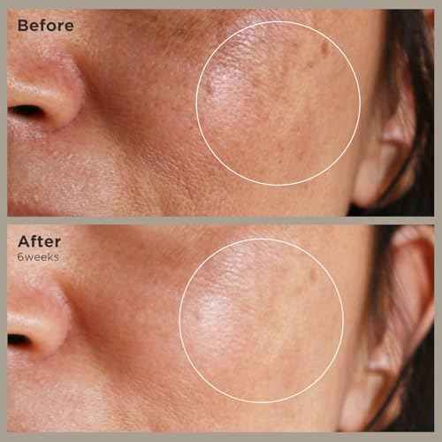 BIOCHEM Nonapeptide-1 Brightening Serum?Dark Spot Corrector & Melanin Inhibitor Ampoule for Even Skin Tone & Natural Glow? Anti-Aging Peptide Treatment for Face & Neck,1.01 fl oz/30 mL