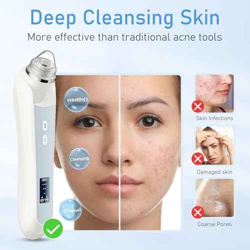 Facial Pore Blackhead Remover Vacuum, 1080P Camera Blackhead Remover, 20x Zoom, 8 LEDs £¦ 3 Suction Modes, 800mAh Battery & USB - 6 Heads Pore Cleaner Kit for Women&Men(White)