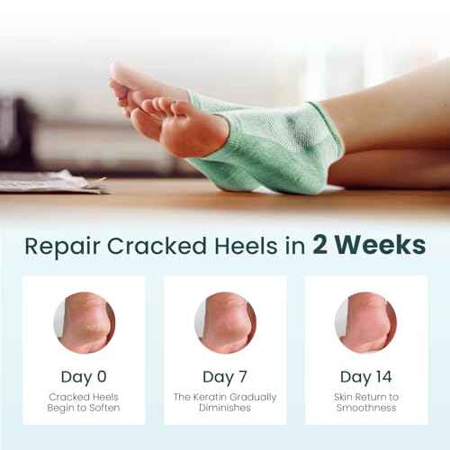 Moisturizing Heel Socks for Cracked Heel Treatment - Promifun 2 Pairs Moisturizer Socks - Heel Socks for Dry Cracked Feet - Cracked Heel Repair - Heel Socks for Women & Men (Green)