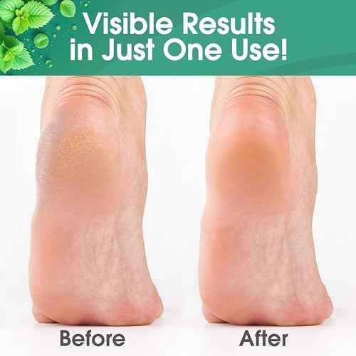 Callus Maintenance Pack, Bundle Includes Mint Scented Callus Remover, Metal Foot Rasp, Foot File, and 4 Pairs of Gloves, Salon Grade Foot Care, Home Manicure and Pedicure Kit