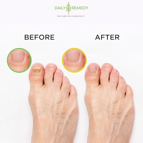 DAILY REMEDY 4-Pack Foot Soak Set - 2 Extra Strength Tea Tree Oil & 2 Citrus Detox - Made In USA - Soothes Tired Feet, Athletes Foot, Stubborn Foot Odor, Softens Calluses & Refreshes & Detoxifies