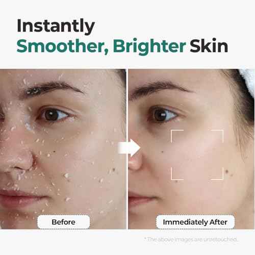 MOTHER MADE LHA Green Tea Exfoliating Aqua Peel Gel, Pore Care, Gentle Facial Exfoliator, Dead Skin Remover, Natural Cellulose for Peeling, Vegan, Korean Skincare, 2 Pack (100ml / 3.38 fl.oz)