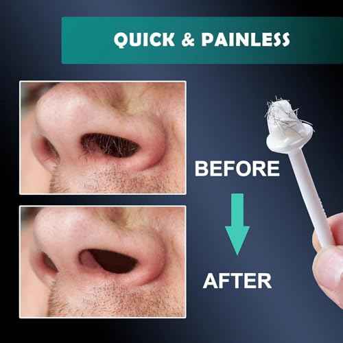 300g Wax Nose Wax Kit, Nose Hair Wax with 10 Waxing Sticks, Quick & Painless Nose Hair Waxing Kit for Men and Women Used at Least 50 Times Usage