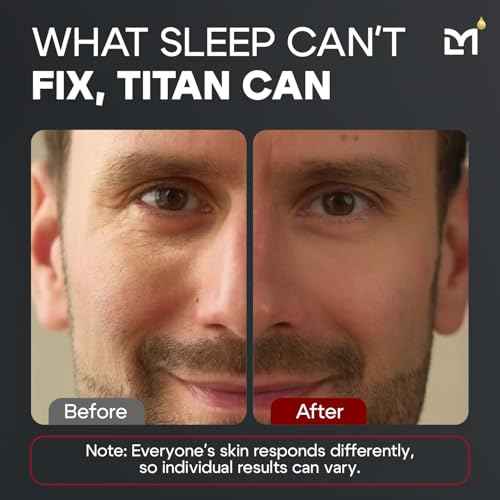 Titan Peptide Anti-Aging Under Eye Gel for Men ? Reduce Appearance of Puffiness, Dark Circles, Eye Bags, & Sagging ? DMAE, Niacinamide, Hyaluronic Acid, Peptides ? All Skin Types ? Unscented