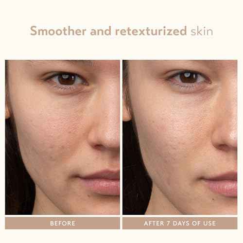 SHANI DARDEN SKIN CARE Lactic Acid Face Serum, Active Night Serum to Help with the Look of Radiant and Smooth Skin, Gentle But Powerful Face Exfoliator, 1.01 fl oz
