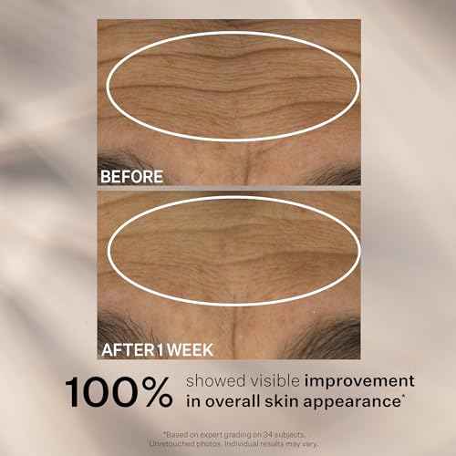 StriVectin Anti-Wrinkle Face Creams and Serums, with Ceramides & Peptides for Firm Skin and Less Wrinkles & Fine Lines