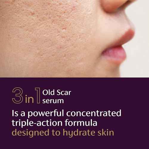 Mederma Scar Serum ? Triple-Action Formula with Vitamin E, Hyaluronic Acid & Niacinamide ? Clinically Shown to Reduce Old Scars, 1 Fl. Oz.