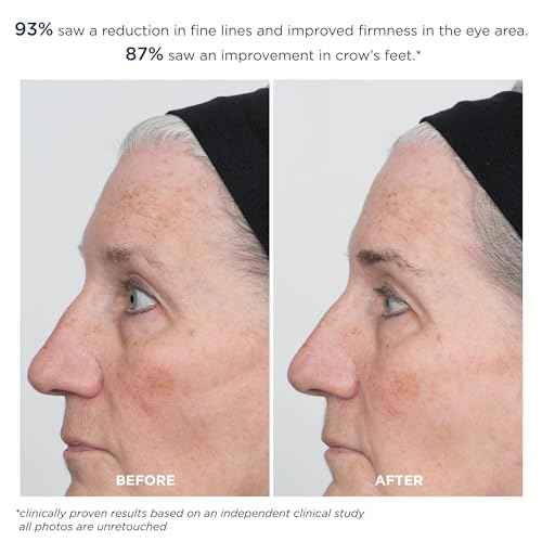 m-61 ProSmooth Retinol Eye Serum | 0.1% Non-Irritating Retinol Eye Serum with Vitamin C, 0.5 Fl Oz