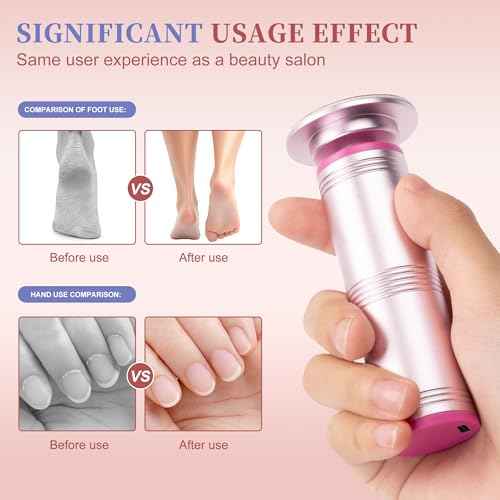 Electric Foot Callus Remover with 60 Sandpaper Discs, Durable Aluminum Adjustable Speed Foot Sander for Cracked, Rough Skin and Calluses, Ergonomic Design ? Cherry Blossom