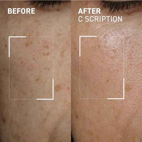 Dr. Brandt Bright This Way C Scription - Concentrated Vitamin C Serum - Fade Dark Spots, Reduce Wrinkles & Illuminate Skin Tone - 1 fl oz
