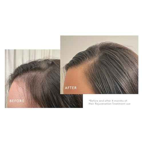 Virtue Flourish Shampoo, Conditioner and Density Booster Treatment Bundle for Thinning Hair for Women, 100% Drug-Free Regimen