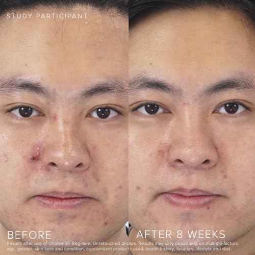 Rodan + Fields UNBLEMISH Invisible Matte Defense Broad Spectrum SPF 30 | Skincare Moisturizer | UV Skin Protection | Sunscreen Face and Neck Cream