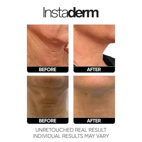 Neck and D?collet? Firming Cream ? Tightening & Lifting Treatment for Crepey, Wrinkles, sagging Skin & Vertical Lines. Anti-Aging Peptide Formula to Boost Hydration & Collagen in the Skin.