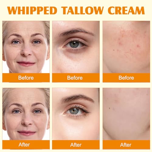 Beef Tallow for Skin, Tallow and Honey Cream Natural Tallow Face Moisturizer,Hydrating Beef Tallow Balm Deeply Moisturizing for Face & Body Skin Care