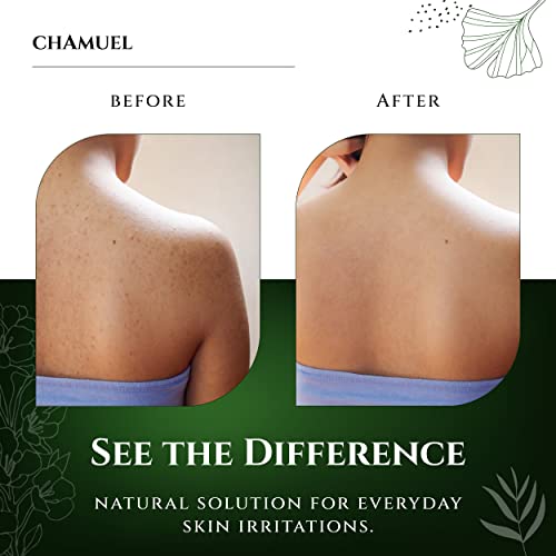 Chamuel Tea Tree Body Wash - Made With Natural Ingredients To Fights Itchy Skin, Body Odor, Athlete's Foot, Jock Itch & Toenails Issues - Organic Scented - Men & Women (11.8oz) 2-Pack