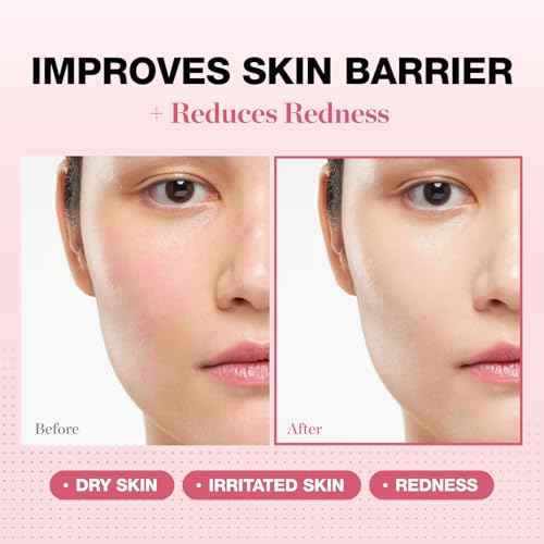 Physiogel Redness Reducing Cream ? Ceramide Moisturizer for Dry, Sensitive & Redness-Prone Skin, Repairs Skin Barrier, Dermatologist-Tested, Fragrance-Free, Korean Skincare, 1.69 fl oz