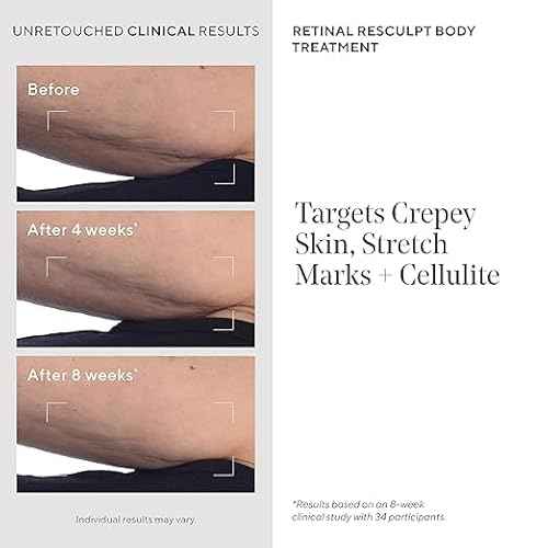 Murad Retinal ReSculpt Body Treatment ? Encapsulated Retinal, Shea & Avocado Extract Body Cream to Firm, Lift, and Smooth Crepey Sagging Skin, Targeting Cellulite and Stretch Marks Nightly ? 5.0 Fl Oz