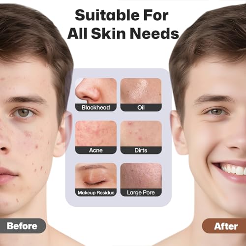 PRITECH Facial Cleansing Brush, Rechargeable Silicone Face Scrubber with Heat Massage End, Vibrating Exfoliator Scrubber for Deep Cleaning, Waterproof Face Brush for Women and Men (Black)