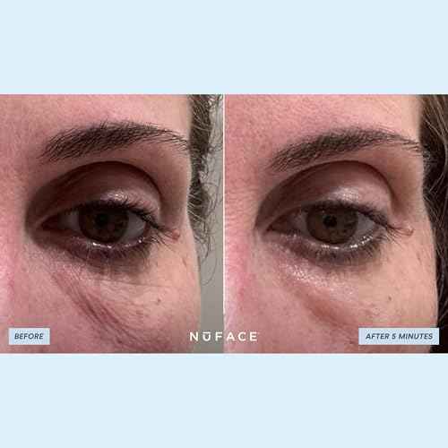 NuFACE IonPlex Hydra-Gel Power Under Eye Patches - Gel Under Eye Mask for Puffy Eyes & Dark Circles - Cooling Wrinkle Patches & Hydrating Treatment Pads to Energize, Brighten & Tighten (60 Count)