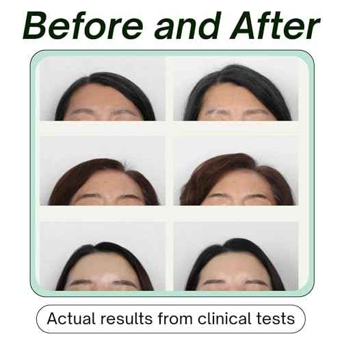 SRILabs KEEWEE Hair Growth Shampoo with Biotin, Niacinamide, Green Tea & Ginkgo ? Thickening for Thinning Hair & Hair Loss | Sulfate-Free, Color-Safe, Scalp-Calming