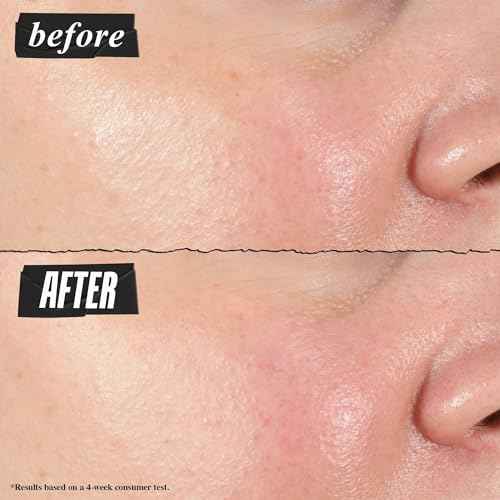 Kiehl's Hydro-Plumping Hydrating Serum, Plumps Skin, Improves Elasticity, Reduces Appearance of Dry Skin, Ophthalmologist and Dermatologist Tested, Fragrance-Free