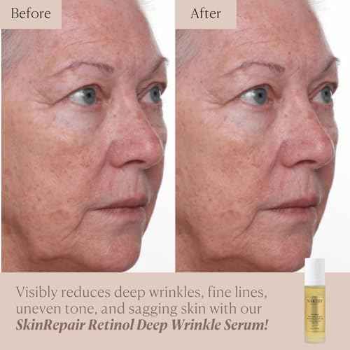 Nakery SkinRepair Retinol Deep Wrinkle Serum (2.02 Fl Oz), Anti Aging Face Serum with Encapsulated Retinol, NAD+ Complex, Ceramide NP, Hydrating Firming Skin Treatment for Fine Lines
