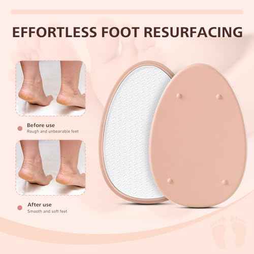 BALUCA Glass Foot File Callus Remover for Feet - Nano Glass Foot Scraper Scrubber Dead Skin Removal for Cracked Heels,Professional Pedicure Tool for Home, Salon, and Travel (Apricot)