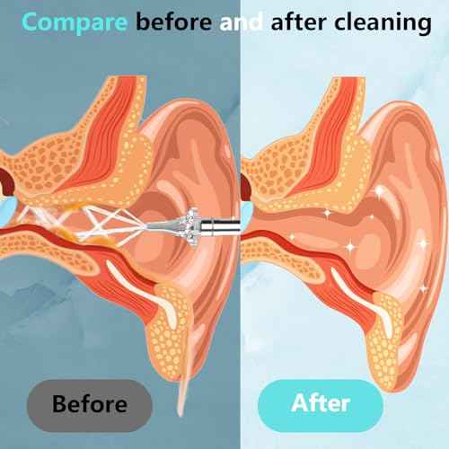 Ear Wax Removal, Portable Water Powered Ear Cleaner with Basin, Electric Ear Cleaning Kit with 3 Pressure Modes, Ear Irrigation Flushing System for Adults and Kids, (Silver)