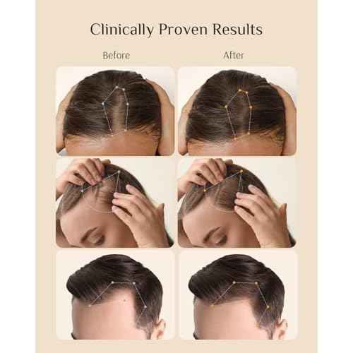 DR ZERO 3% Redensyl Hair Growth Serum for Women, Hair Scalp Serum Spray for Hair Loss and Regrowth, Clinically Tested for Hair Thinning Therapy and Scalp Care, Japanese Hair Treatment, 60ml