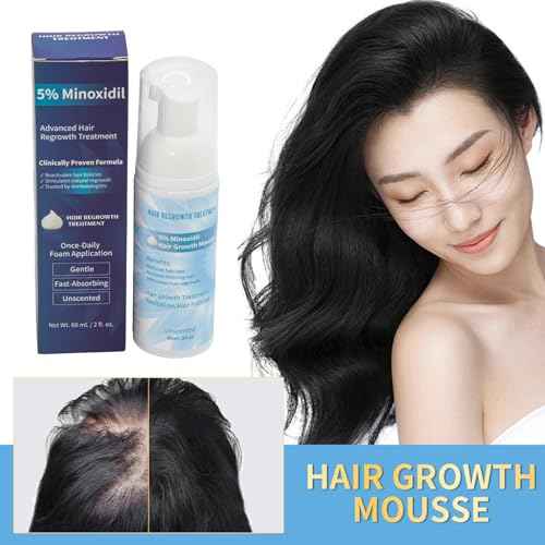 Minoxidil 5% Foam for Hair Growth, Topical Hair Loss Treatment for Men and Women, 3 Pack (2 oz Bottle) (1PC)
