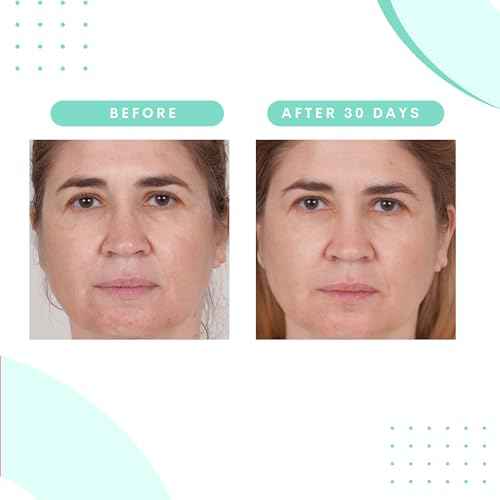Serious Skincare Glycolic Acid Face Wash Cleanser 12 oz. + Ultrasonic Facial Cleansing Brush Tool for Women & Men, Gentle, Creamy, Oil Free + Skin Retexturizing Formula, Makeup +Blackhead Remover