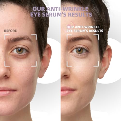 5% Caffeine Eye Cream & Under Eye Serum for Dark Circles and Puffiness, 360¡Æ Massage Roller Ball Eyes Treatment Serum, Reduces Wrinkles Fine Lines for Women
