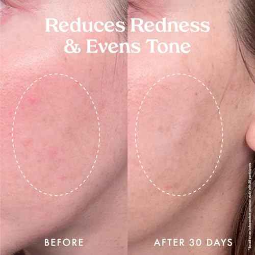 Kopari Star Bright Vitamin C Discoloration Correcting Serum with Kakadu Plum & Niacinamide, Brighter Complexion, Soothe & Diminish Dull Skin, 1.7oz