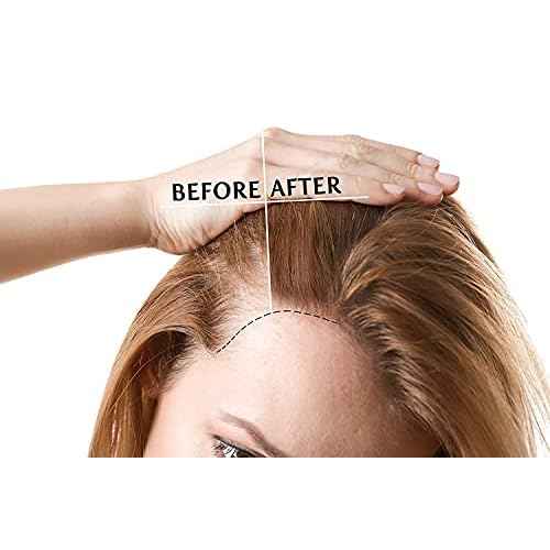 Pure Fractionated Coconut Oil - Pure, Fractionated - Perfect for Skin, Face, Hair, Nails - (16 oz)