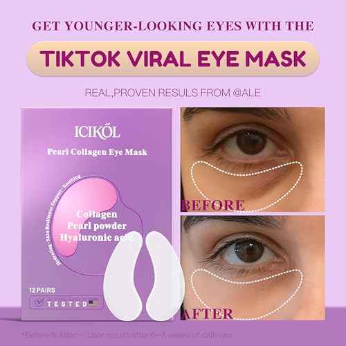 Collagen Under Eye Patches for Puffy Eyes and Dark Circles, Under Eye Mask for Puffiness, Hydrating Undereye Mask Patches for Treatment with Women Beauty (White, 12 Pairs)