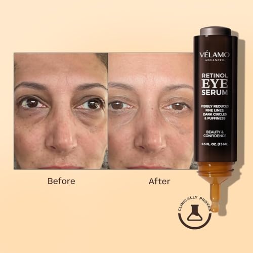 Retinol Eye Cream Anti Aging: Under Eye Cream for Dark Circles Puffiness Eye Bags - Help Reduce Appearance of Wrinkles Fine Lines - with Caffeine Peptides Hyaluronic Acid Ceramides 0.5 FL OZ/15mL