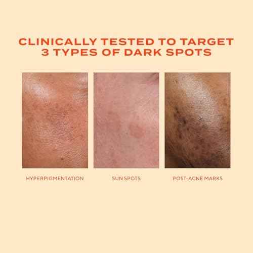 Murad Rapid Dark Spot Correcting Serum - Advanced Anti-Aging Formula with Patented Resorcinol Technology, Tranexamic and Glycolic Acids for Hyperpigmentation, Dark Spots and Dull Skin - 1 Fl Oz