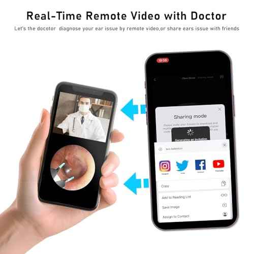 Note5 Ear Wax Tweezers with Camera, 10MP Ear Cleaner Camera Otoscope with Light,Real-time Remote Video with Ear Pick & Tweezers,12 Pcs Ear Scoops for Whole Family